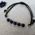 Vista general de la pulsera